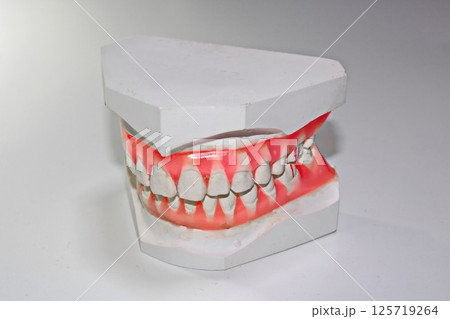 石こう歯型模型　歯科イメージ　矯正模型 125719264