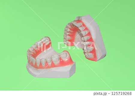 石こう歯型模型　歯科イメージ　矯正模型 125719268