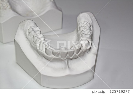 石こう歯型模型　歯科イメージ　矯正模型 125719277