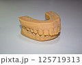 歯科3D模型　アライナー矯正用　矯正模型 125719313