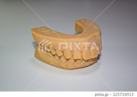 歯科3D模型　アライナー矯正用　矯正模型 125719313
