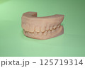 歯科3D模型　アライナー矯正用　矯正模型 125719314