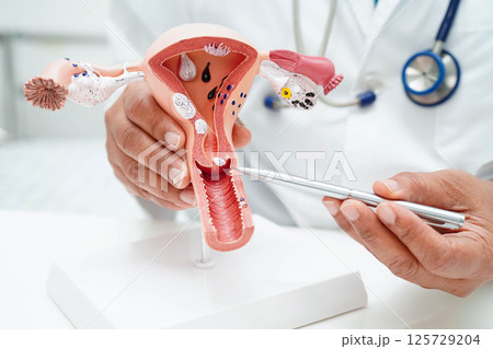 Uterus, doctor holding human anatomy model for study diagnosis and treatment in hospital. 125729204