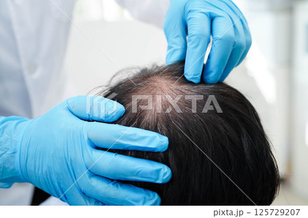 Doctor touch bold head in man, hair loss treatment health problem. Doctor touch bold head in man, hair loss treatment health problem. 125729207