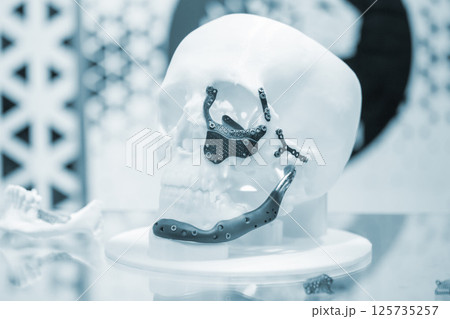 Prototype of human skull from white plastic with titanium implants in form of plates and surgical templates printed on 3D printer. Biointegrated prosthesis. Medicine medical Prototype of human skull from white plastic with titanium implants in form of plates and surgical templates printed on 3D printer. Biointegrated prosthesis. Medicine medical 125735257