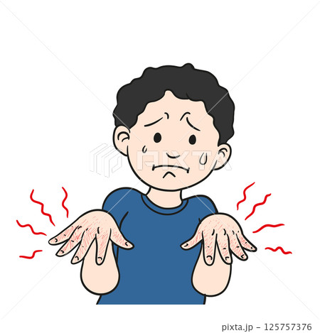 man with burnt hand, Suffering from Cracks man with burnt hand, Suffering from Cracks 125757376