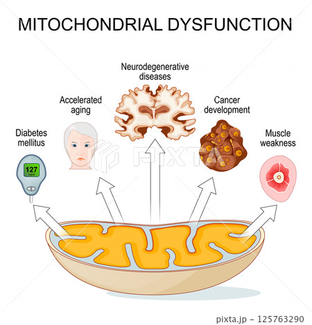 Mitochondrial dysfunction 125763290
