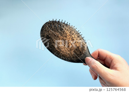 Woman holding a hair brushes with lots of hair falling out. Hair loss concept Woman holding a hair brushes with lots of hair falling out. Hair loss concept 125764568