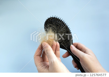 Woman holding a hair brushes with lots of hair falling out. Hair loss concept 125764577