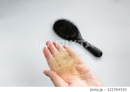 Woman holding a bunch of fallen hair in her hand. Hair loss concept Woman holding a bunch of fallen hair in her hand. Hair loss concept 125764593