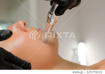Microneedle RF lifting procedure. A cosmetologist performs a facial rejuvenation procedure on a woman. Hardware cosmetology. Microneedle RF lifting procedure. A cosmetologist performs a facial rejuvenation procedure on a woman. Hardware cosmetology. 125778132