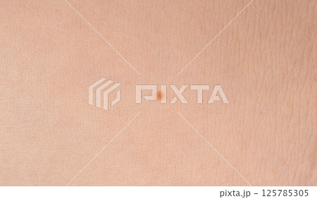 Skin mole spot closeup. Human birthmark, nevus macro texture Skin mole spot closeup. Human birthmark, nevus macro texture 125785305