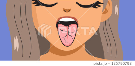 Close Up of Woman With Fissured Tongue Cartoon Vector Illustration 125790798