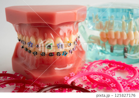 Orthodontic ligatures rings and ties, elastic rubber bands on orthodontic braces, model for dentist studying about dentistry. Orthodontic ligatures rings and ties, elastic rubber bands on orthodontic braces, model for dentist studying about dentistry. 125827176