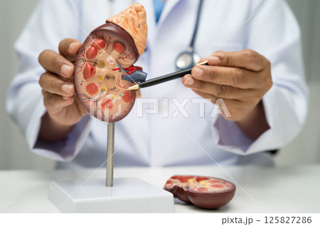 Chronic kidney disease, doctor with model for treatment urinary system, urology, Estimated glomerular filtration rate eGFR. Chronic kidney disease, doctor with model for treatment urinary system, urology, Estimated glomerular filtration rate eGFR. 125827286