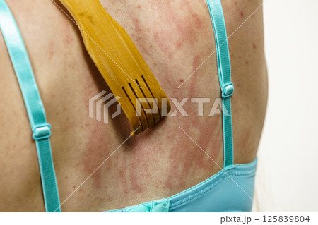Woman scratching her itchy back using scratcher Woman scratching her itchy back using scratcher 125839804