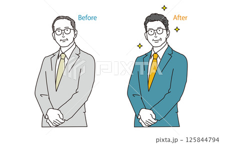 薄毛の男性と毛髪トラブルのビフォーアフター 125844794
