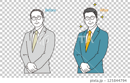 Before and after of men with thinning hair and hair problems 125844794