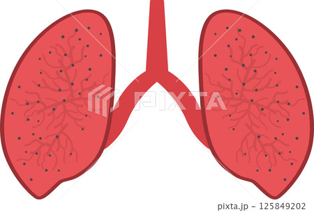 Lung disease with dust and pollution. 125849202