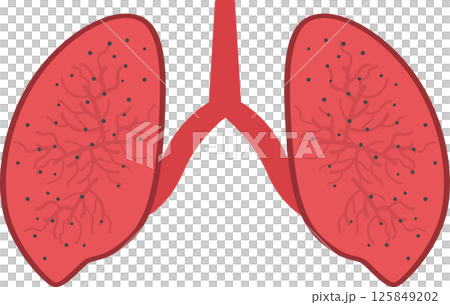 Lung disease with dust and pollution. 125849202