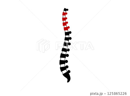 Scoliosis medical poster 125865226