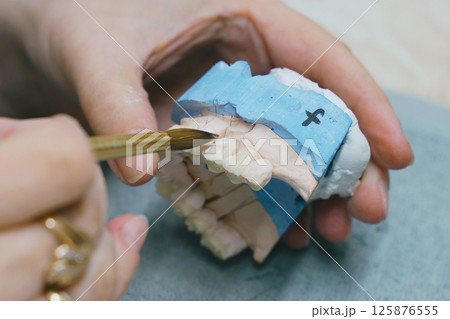 Crafting precision in dental prosthetics through skilled craftsmanship Crafting precision in dental prosthetics through skilled craftsmanship 125876555