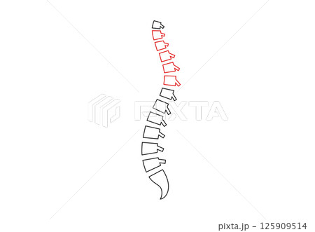 Scoliosis medical poster Scoliosis medical poster 125909514