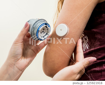 Medical device for glucose check. Continuous glucose monitoring pod. Modern wireless technology. 125921918