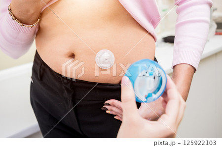 Doctor install patient insulin catheter for a simple injection of insulin. Doctor install patient insulin catheter for a simple injection of insulin. 125922103