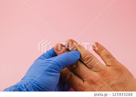 Foot care procedure with medical gloves on patients toes 125933288