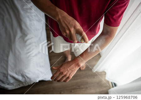 Man spraying spf healing cream on burned arm after harsh sun. Overexposure after careless outing 125968706