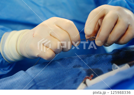Operations to remove blood clots. Prevention of blood clots. Endovascular surgery. Surgical interventions on blood vessels. Operations to remove blood clots. Prevention of blood clots. Endovascular surgery. Surgical interventions on blood vessels. 125988336