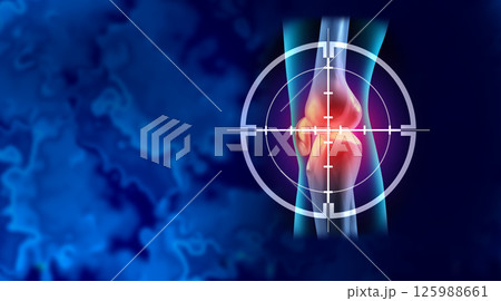 Targeting Knee Pain Targeting Knee Pain 125988661