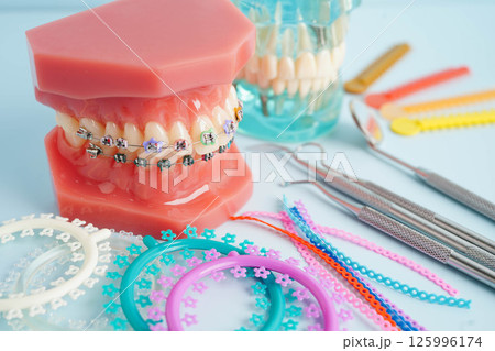 Orthodontic ligatures rings and ties, elastic rubber bands on orthodontic braces, model for dentist studying about dentistry. 125996174