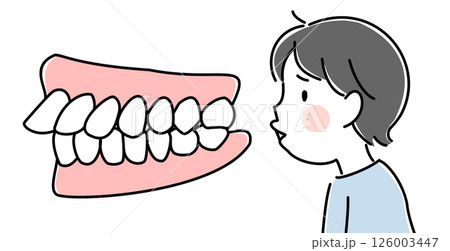 出っ歯(上顎前突)で困っている子供と歯並びのイラスト 出っ歯(上顎前突)で困っている子供と歯並びのイラスト 126003447