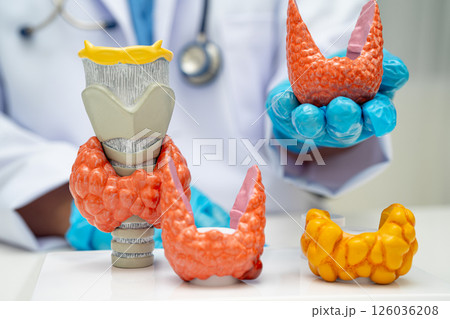 Hyperthyroidism, Overactive Thyroid, Thyroid Lymphoma, Asian doctor with thyroid gland human anatomy model in hospital. Hyperthyroidism, Overactive Thyroid, Thyroid Lymphoma, Asian doctor with thyroid gland human anatomy model in hospital. 126036208