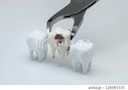 立体 3次元 3D 126065335