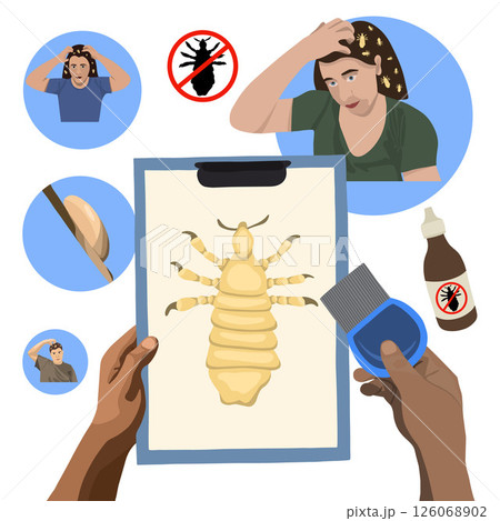 Vector isolated illustration of pediculosis disease set. People with pediculosis. Combing nits. A remedy for pediculosis. 126068902