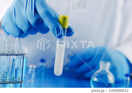 man holding a test tube with semen in a laboratory 126080032