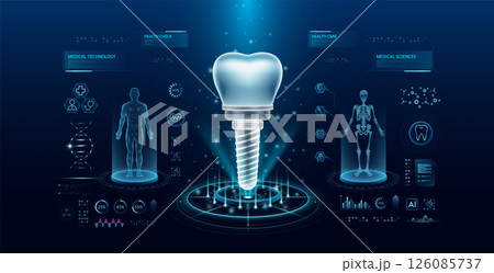 Dental implant health care technology with scan virtual interface hologram style. X ray and MRT human body examination. Medical diagnostic with HUD, UI, GUI. Analysis in futuristic laboratory. Vector  126085737