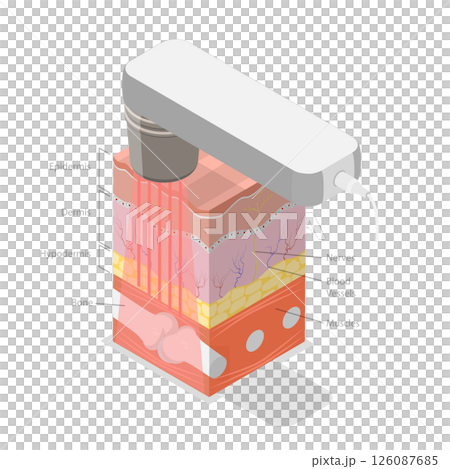 3D Isometric Flat Illustration of Laser Therapy, Alleviating Patient Pain And Stimulate Healing 3D Isometric Flat Illustration of Laser Therapy, Alleviating Patient Pain And Stimulate Healing 126087685