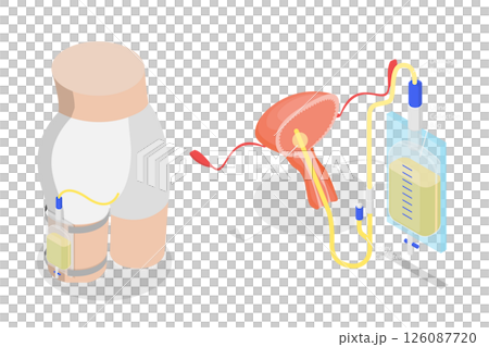 3D Isometric Flat  Illustration of Drainage Bladder, Flexible Rubber Urine Bag For Bladder Infections Treatment 126087720