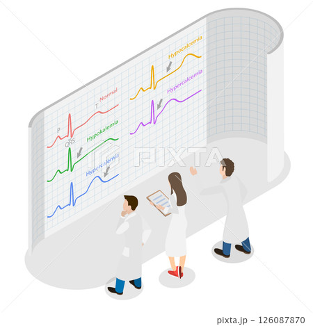 3D Isometric Flat  Illustration of ECG Changes, Cardiac Rhythms 126087870