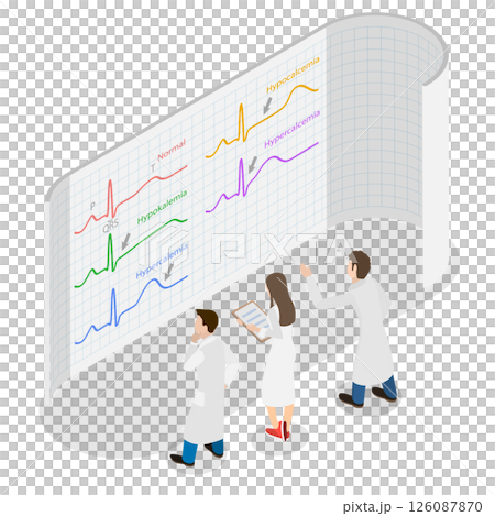 3D Isometric Flat  Illustration of ECG Changes, Cardiac Rhythms 126087870