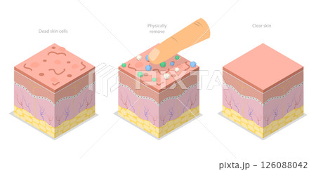 3D Isometric Flat  Illustration of Skin Peeling, Mechanical Exfoliation For Skin Renewal 126088042