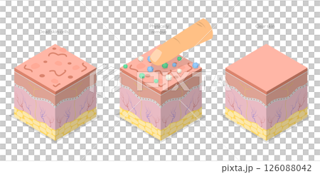 3D Isometric Flat  Illustration of Skin Peeling, Mechanical Exfoliation For Skin Renewal 126088042