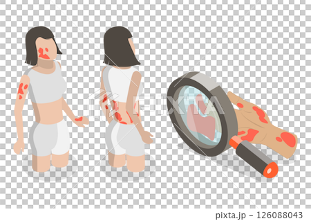 3D Isometric Flat  Illustration of Atopic Dermatitis, Person With Eczema Scratches Itchy Skin 126088043