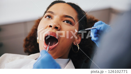 Woman, dentist or tools in consultation for oral care, plaque removal or cavity inspection in mouth. Patient, orthodontist hands or dental examination in practice for cleaning, check gums or service 126102771