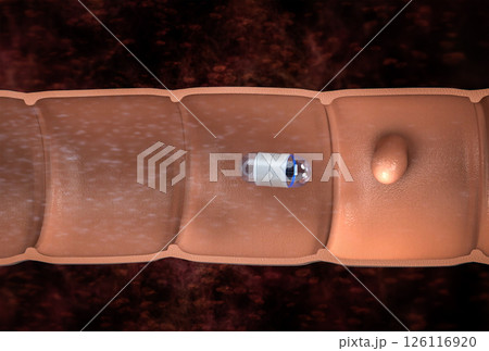 Capsule endoscopy in intestine cutaway 126116920