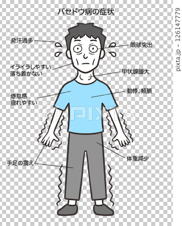 Signs and symptoms of Graves' disease in men 126147779